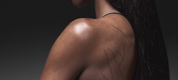 Paola Egonu